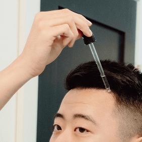 hair loss